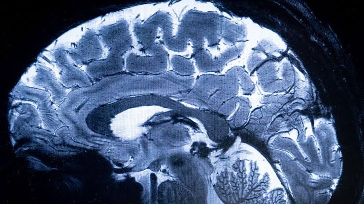 Brain Dramatically Remodels Its Cellular Composition, Starting in Midlife