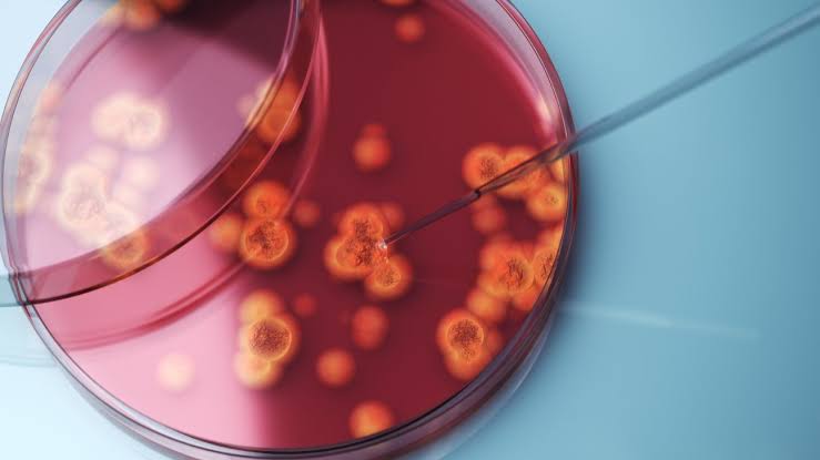 Drug-Resistant ‘Superbug’ Confirmed in 23 States: Should You Worry?