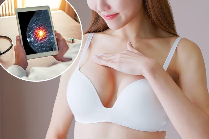 French ‘smart bra’ could help detect early signs of breast cancer