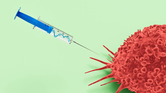 Pancreatic Cancer Vaccine Triggers Immune Response Before Tumors Develop