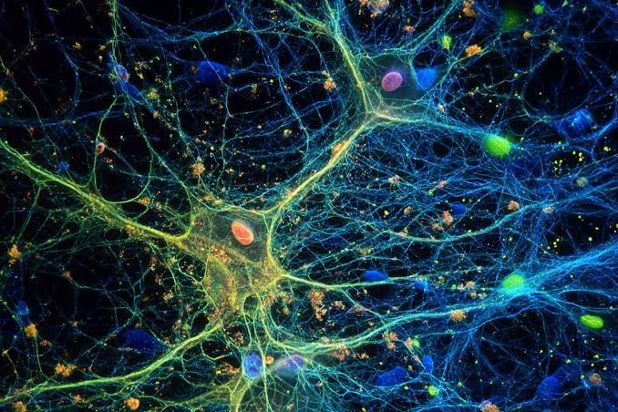 Microglial State Transitions Dictate Alzheimer’s