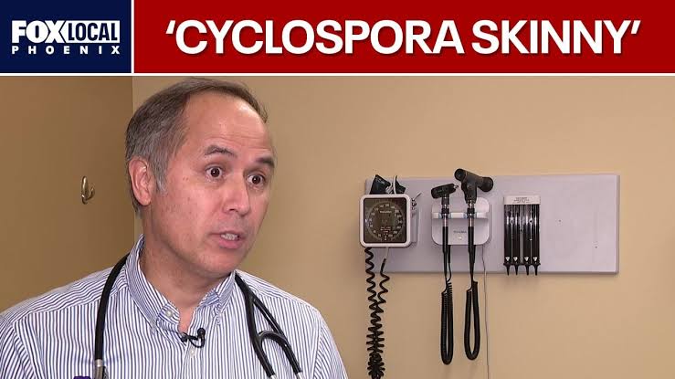Doctors warn 'Cyclospora skinny' trend is risky