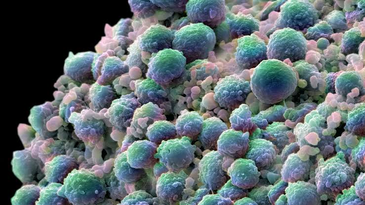 Experimental treatment kills prostate tumor cells while reawakening antitumor immunity