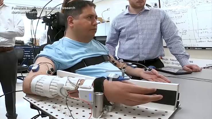 Man paralyzed from chest down undergoes first-of-its-kind procedure on LI