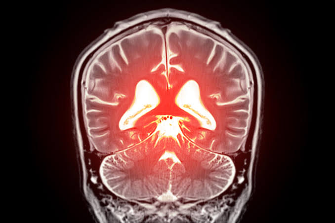 Scientists Have Identified a Key Driver of Age-Related Cognitive Decline