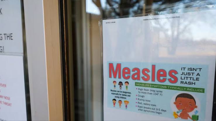 Measles case in King County infant prompts exposure warning in Bellevue, Seattle