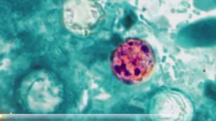 Nearly 7,000 cases of cyclosporiasis confirmed or under investigation nationwide, CDC says