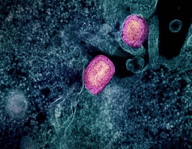 SF health officials urge vaccinations after new case of monkeypox reported
