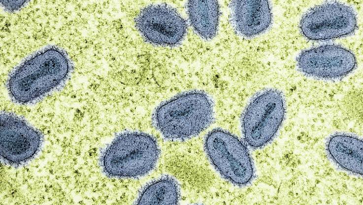 Foreign nationals working at NIH charged with smuggling monkeypox into US at Metro Airport