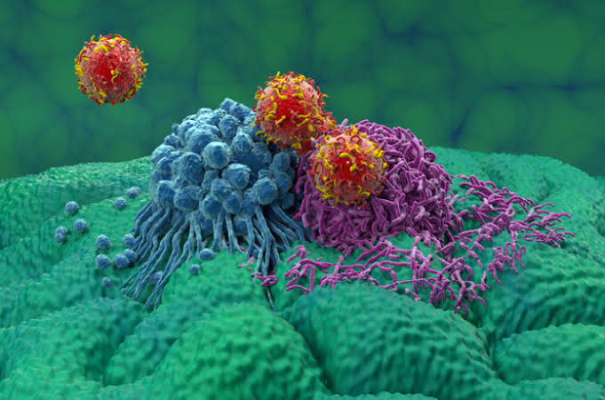 CAR T Cells Simultaneously Target Glioblastoma and Immune Cells