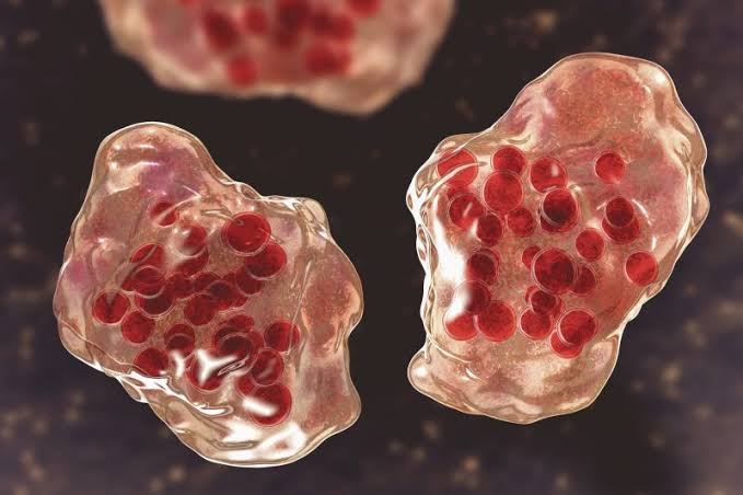 Maryland confirms 12th measles case in the state this year