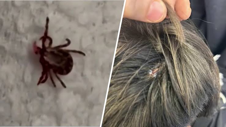 What is rabbit fever? Cases of rare tick-borne illness reported on Long Island