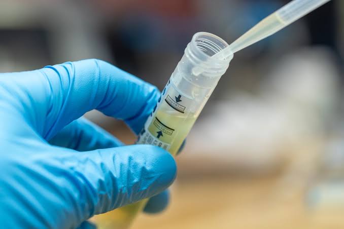 These Alabama counties have the highest rates of STDs