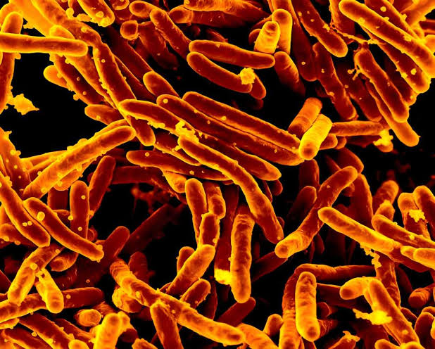 Long a dream, it's now real: a fast and accurate TB test that doesn't need phlegm