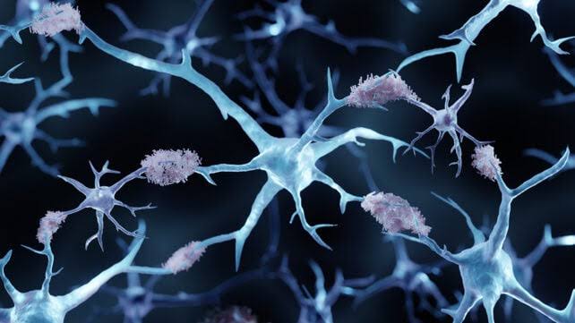 A Copper-Based Drug Clears Buildup of Alzheimer's Proteins in Mice