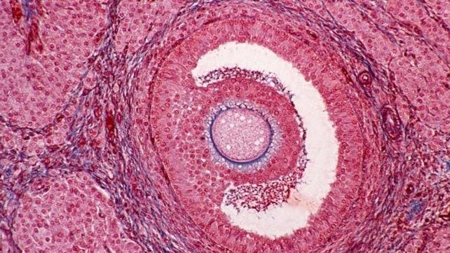 Ovaries Begin Aging Decades Before Menopause – And The Implications Go Far Beyond Fertility