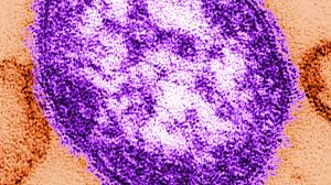 4 measles exposure sites identified across the greater Portland area