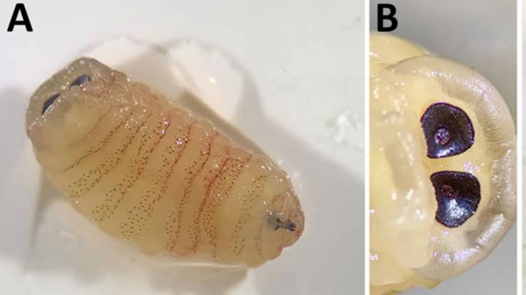 Diagnostic dilemma: Woman's 'biologically implausible' infection led her to sneeze 'worms' out of her nose