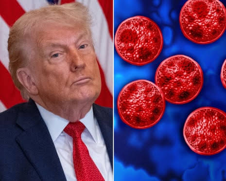 Trump’s deep public health cuts hinder response to record US cyclosporiasis outbreak