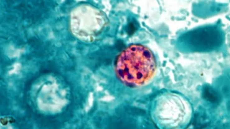 Doctor: ‘Don’t panic’ as Michigan tracks cyclosporiasis outbreak
