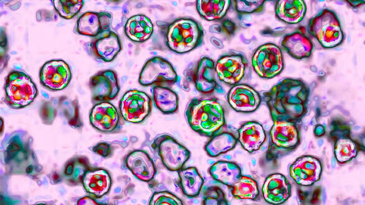 US measles cases surpass 2,000 for the 2nd year in a row: CDC