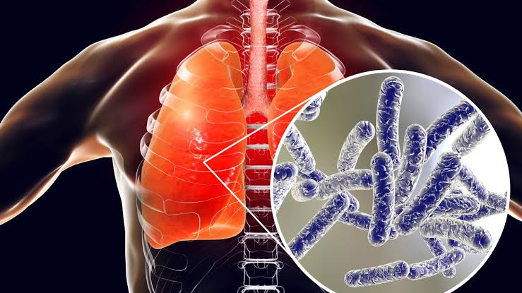 Legionnaires' disease outbreak on Upper East Side expands again: What to know