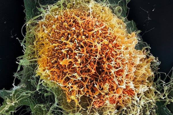 Why the Ebola and Hantavirus Outbreaks Have Confounded Scientists