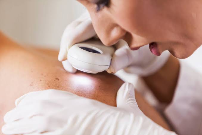 Dermatologists Reveal the Most Overlooked Early Sign of Skin Cancer You Shouldn't Ignore