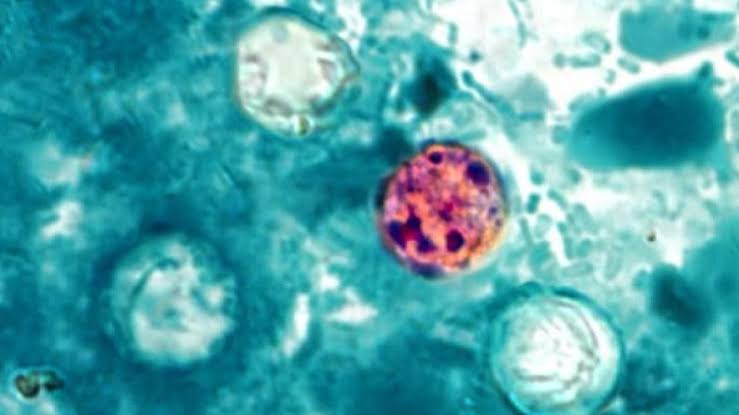 Cases of ‘explosive' diarrhea parasite soaring in Michigan, Illinois