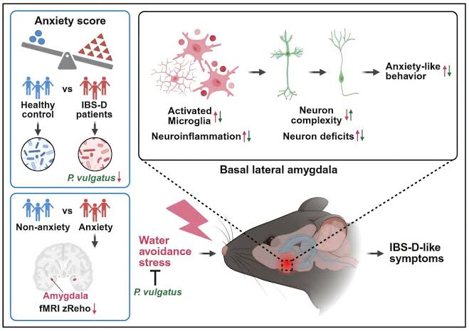 A species of gut bacteria could ease anxiety and diarrhea-predominant IBS