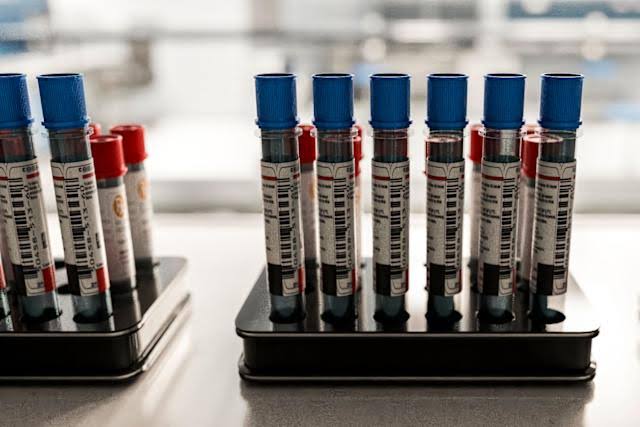 Patients say they want Alzheimer's blood tests. Doctors aren't sure they help.