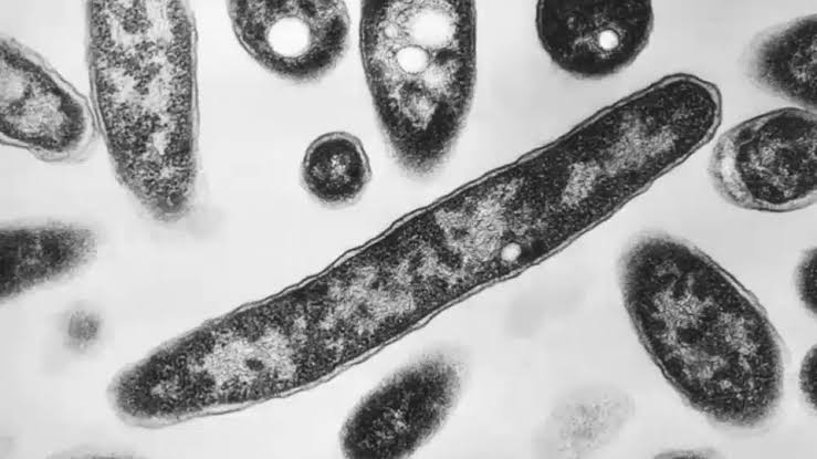 Legionnaires' outbreak: 2nd victim to die in UES cluster was Air Force veteran, businessman