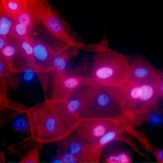 Many cancer patients don’t get genomic tests to guide treatment, study finds