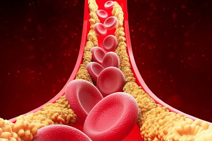 Experts have found a new type of cholesterol. And it could be the most dangerous