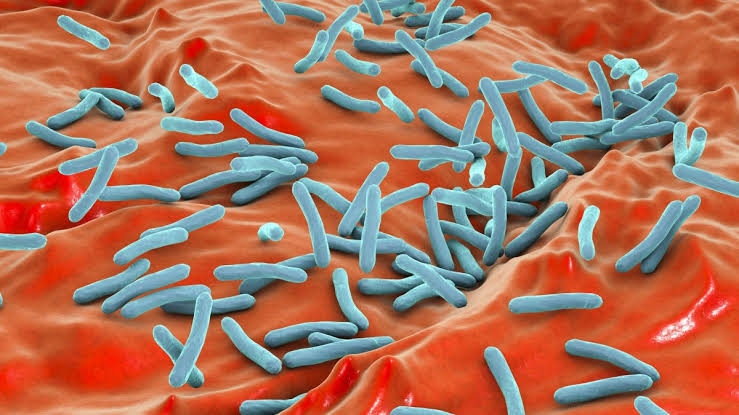 CSU San Marcos, NCTD Sprinter exposed to tuberculosis