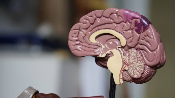 Iron In The Brain May Secretly Disable Neurons Long Before They Die, Study Finds