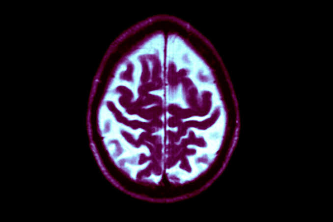 We’re not as helpless against dementia as we think