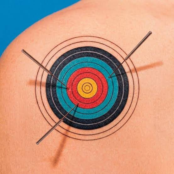 Does Dry Needling Really Relieve Pain?
