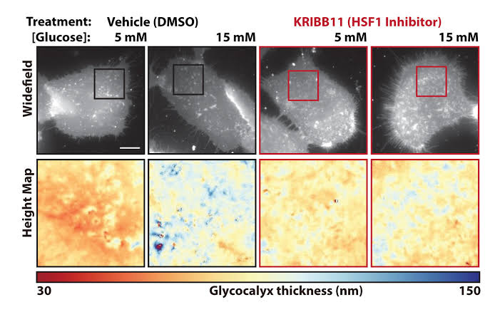 High glucose thickens cancer cells' sugar shield, helping them evade immune attack