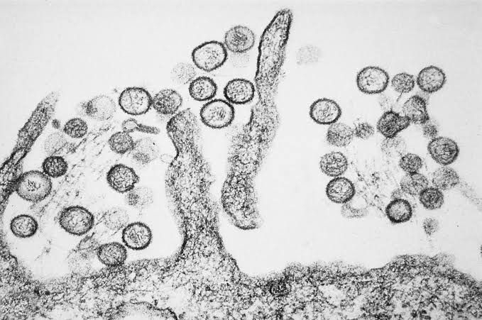 Canadian passenger now presumed positive for hantavirus