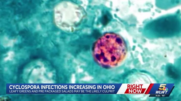 Cyclospora outbreak: Hamilton County reports additional cases