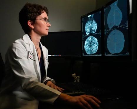 Groundbreaking genomic test could spare millions of breast cancer patients chemotherapy