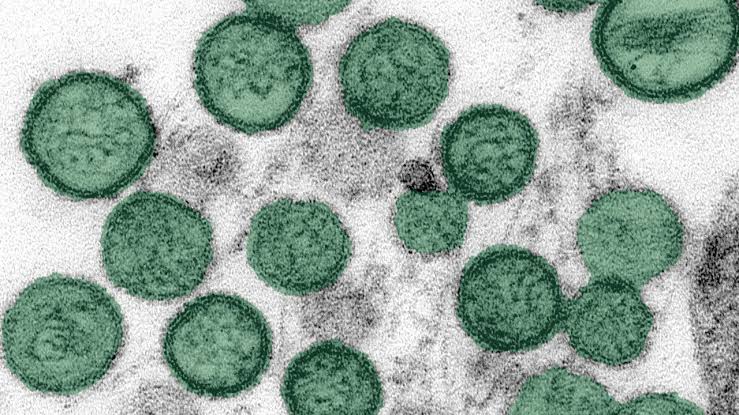 Arapahoe County man recovering after contracting hantavirus; infection not tied to cruise ship cluster