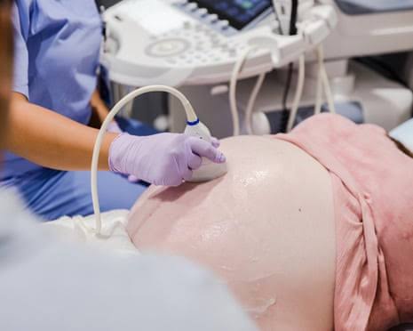 ‘Forever chemicals’ linked to gut inflammation in children after early exposure