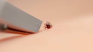 Found a Tick? Here Are the 6 Things You Should Do Next