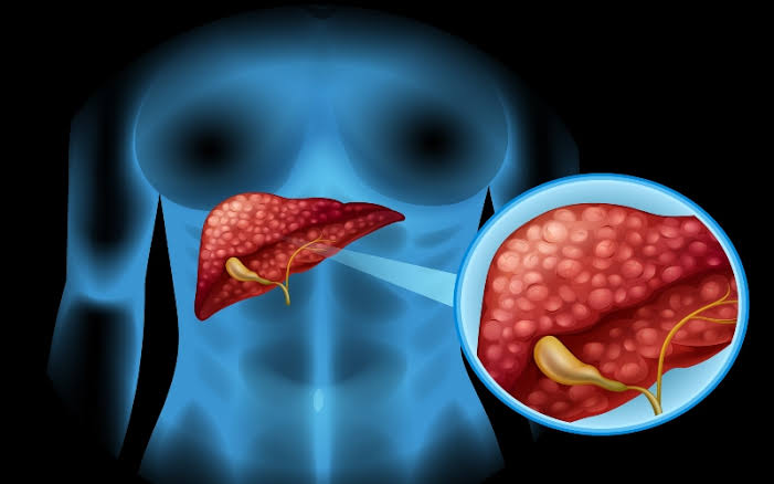 New vaccine shows promise in preventing pancreatic cancer