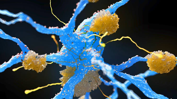 Weight-Loss Drugs May Reduce Buildup of Alzheimer's Proteins, Major Review Finds