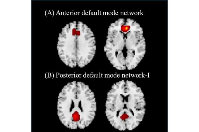 Vitamin C levels in blood plasma linked with brain connectivity and volume in older adults