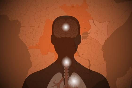 Tracking the 2026 Ebola outbreak in maps and figures: Locations, severity, how contagious it is and more