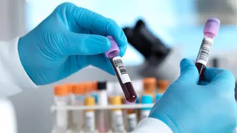Two possible Ebola cases in Brazil ruled out as patients test negative